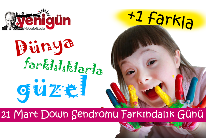 Dünya farklılıklarla güzel..