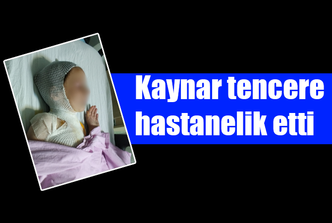 Kaynatılırken taşan süt çocuğu hastanelik etti