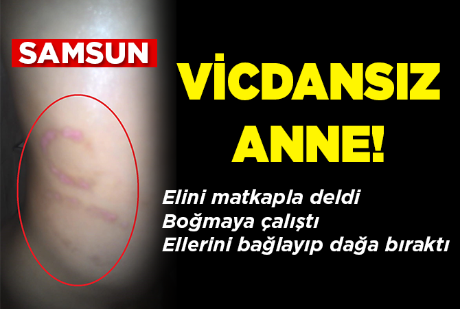7 YAŞINDAKİ ÇOCUĞA ANNESİNDEN İŞKENCE İDDİASI
