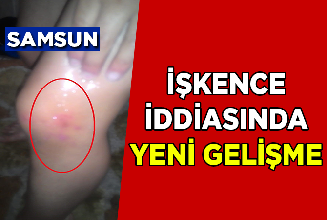 İŞKENCE İDDİASINDA YENİ GELİŞME
