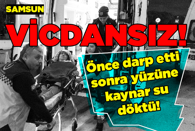 Eşini darp edip üzerine kaynar su döküp yaktı