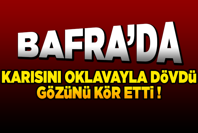 Bafra’da karısını oklavayla döverek gözünü kör etti