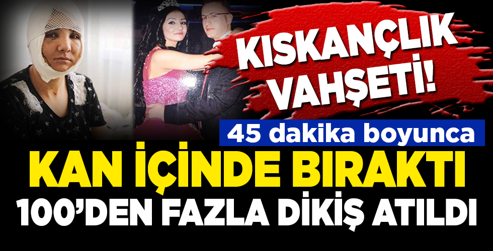 Kıskançlık vahşeti! Yüzünü ve boğazını kesti, 100’den fazla dikiş atıldı