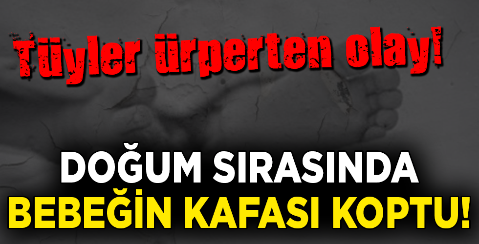 KORKUNÇ OLAY! DOĞUM SIRASINDA BEBEĞİN KAFASI KOPTU