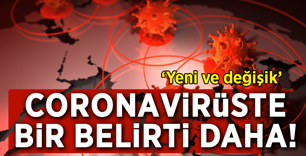 Bilim Kurulu Üyesi Taşova: Uykusuzluk bulgusu da koronavirüsle ilişkilendirildi