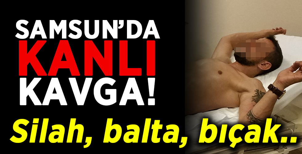  Samsun’da kavgada 2 kişi hastanelik oldu