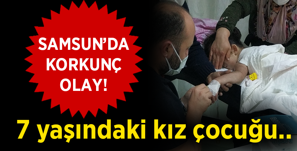 Kaynar su dolu kazana düşen çocuk hastanelik oldu Yeni