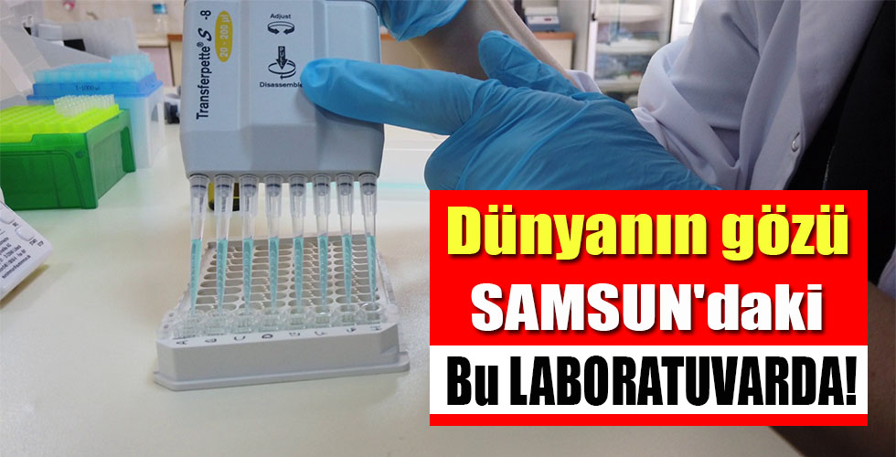Dünyanın gözü SAMSUN’daki Bu LABORATUVARDA!