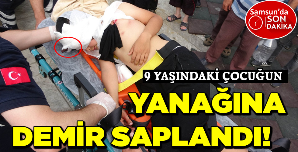 YANAĞINA DEMİR SAPLANDI!