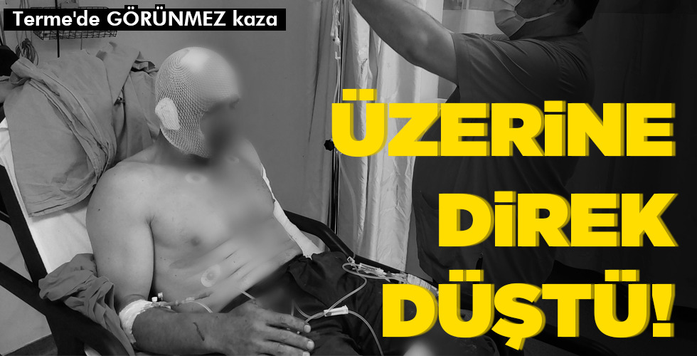 ÜZERİNE DİREK DÜŞTÜ!