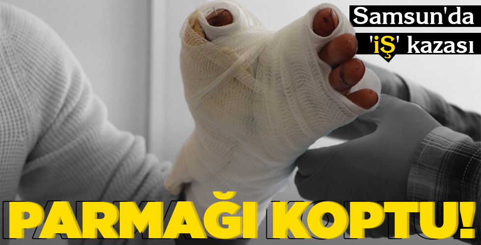 PARMAĞI KOPTU!