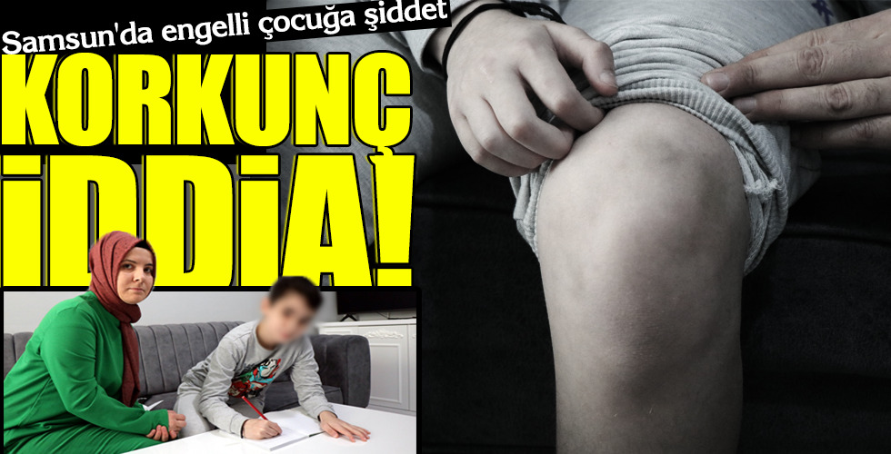 KORKUNÇ İDDİA!