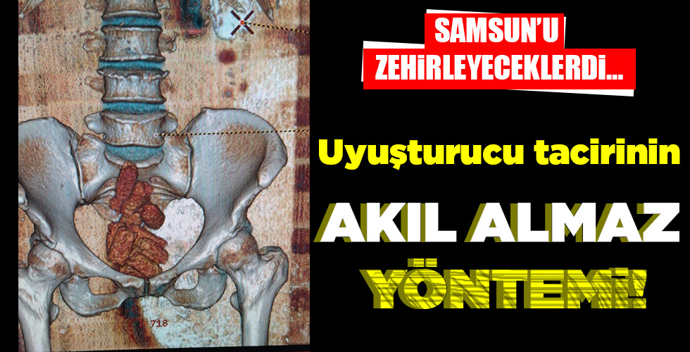 Uyuşturucu tacirinin AKIL ALMAZ YÖNTEMİ!