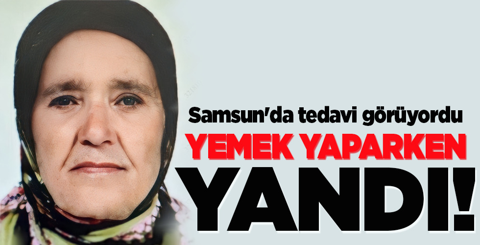 YEMEK YAPARKEN YANDI!
