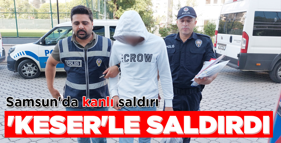 Samsun’da kanlı saldırı