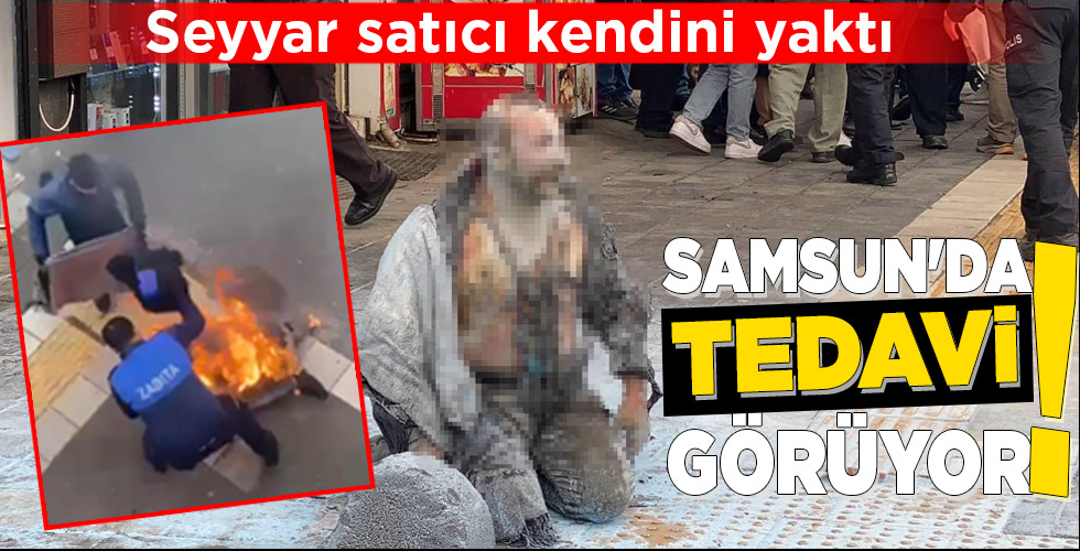 SAMSUN’DA TEDAVİ GÖRÜYOR!