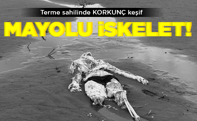 MAYOLU İSKELET!
